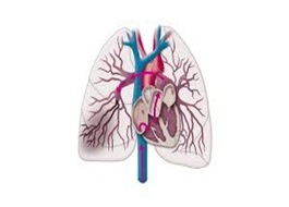 Embolie pulmonaire